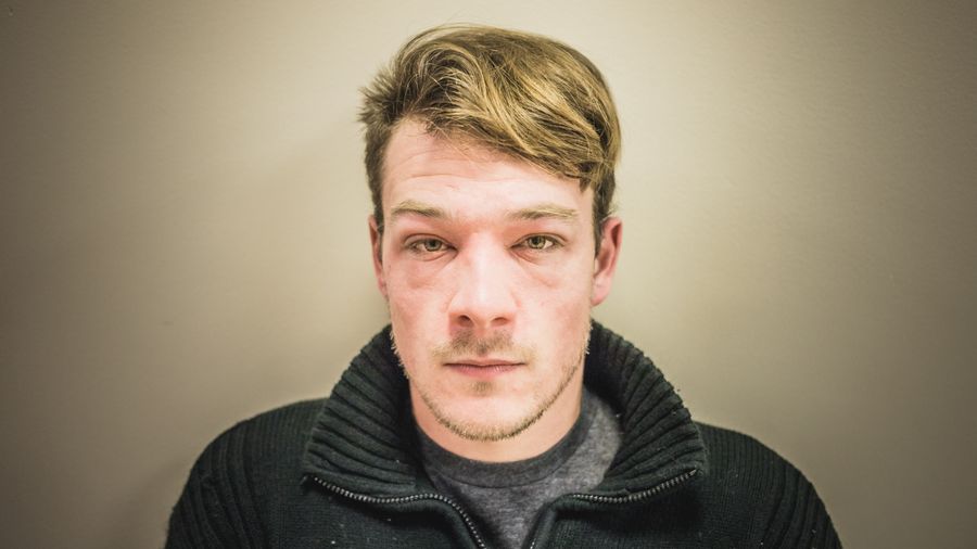 Neurodermitis und Prädilektionsstellen